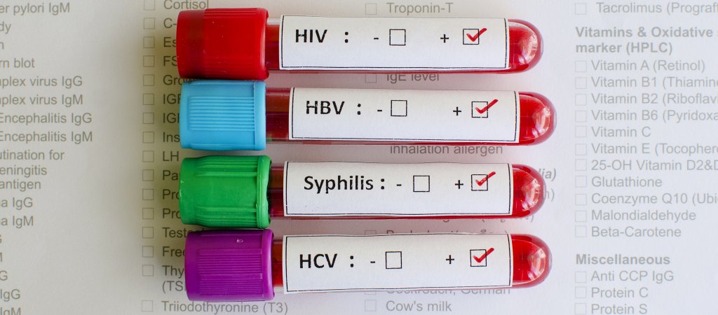 13 Checkpoints für HIV- und STI-Tests