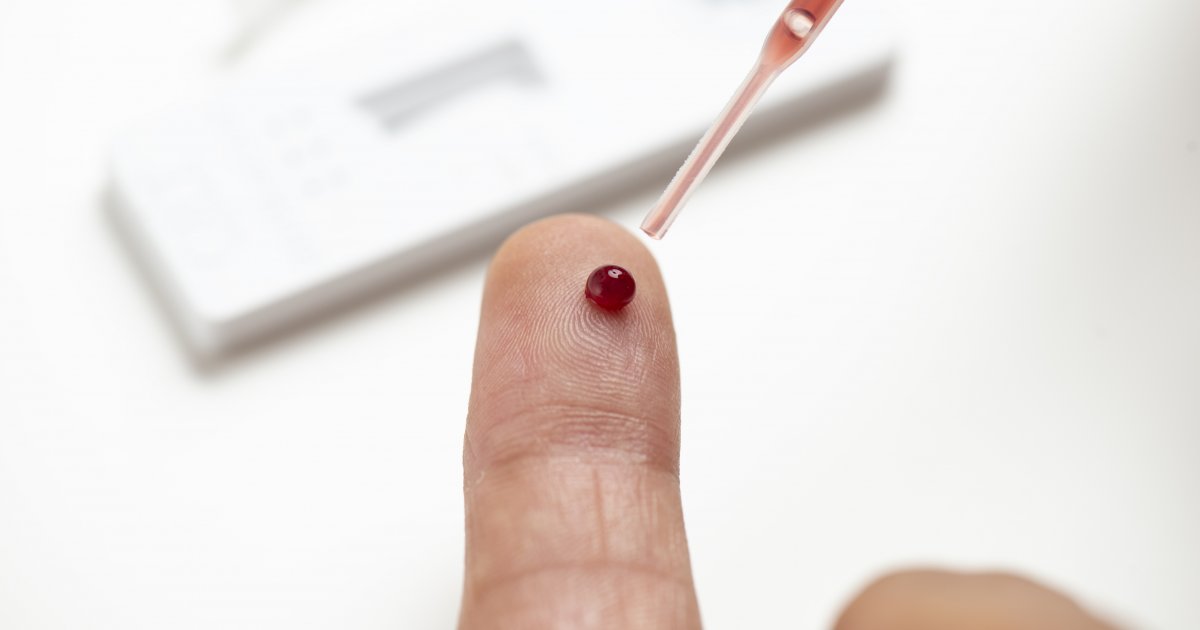 Revolution bei HIVTests! Neues Verfahren macht es noch einfacher!