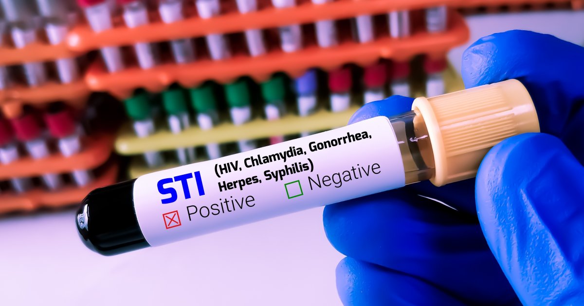 Kampf gegen STI Massiv steigende Fallzahlen in der Schweiz