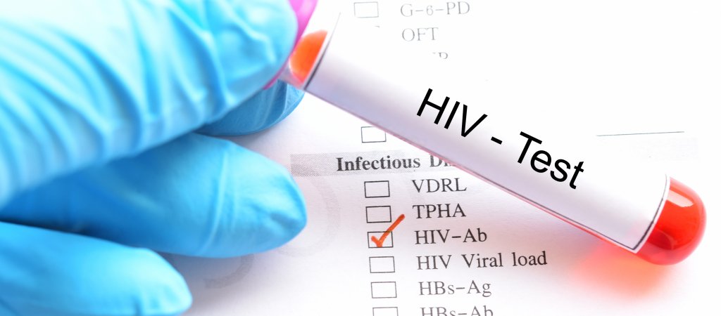HIV Test // © jarun011