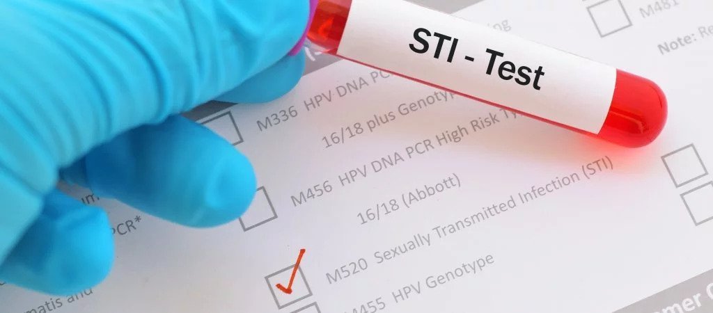 Ein Meilenstein: Gratis STI-Tests in Kalifornien