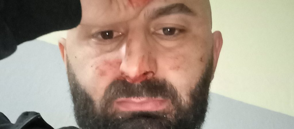 LGBTI*-Aktivist aus Montenegro beim Grabbesuch verprügelt