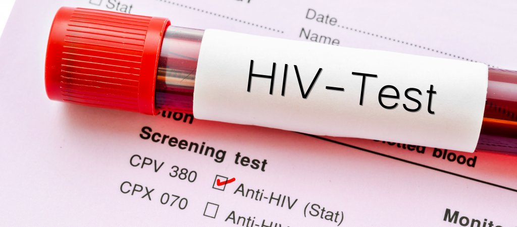 Ende von HIV-Tests im Job?