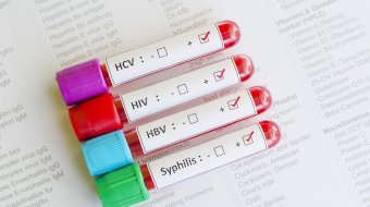 HIV-SYPHILIS-SCHNELLTESTS