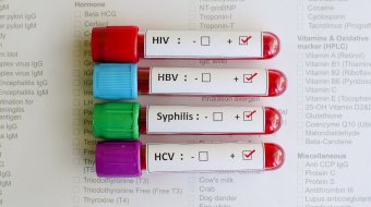 13 Checkpoints für HIV- und STI-Tests
