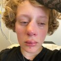 Angriff auf 14-jährige Amsterdamerin 