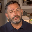 Schwuler Mann aus Ford Lauderdale vor seinem Haus verprügelt